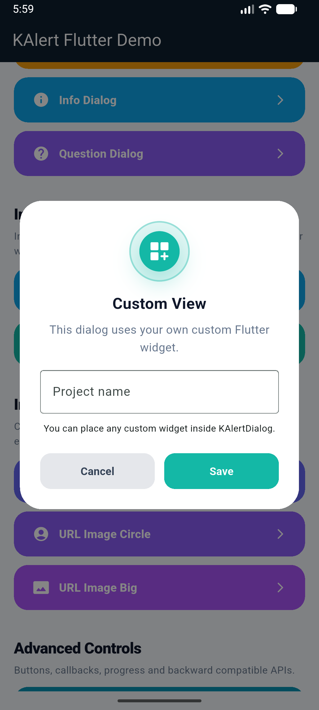 KAlertFlutter Custom View Dialog